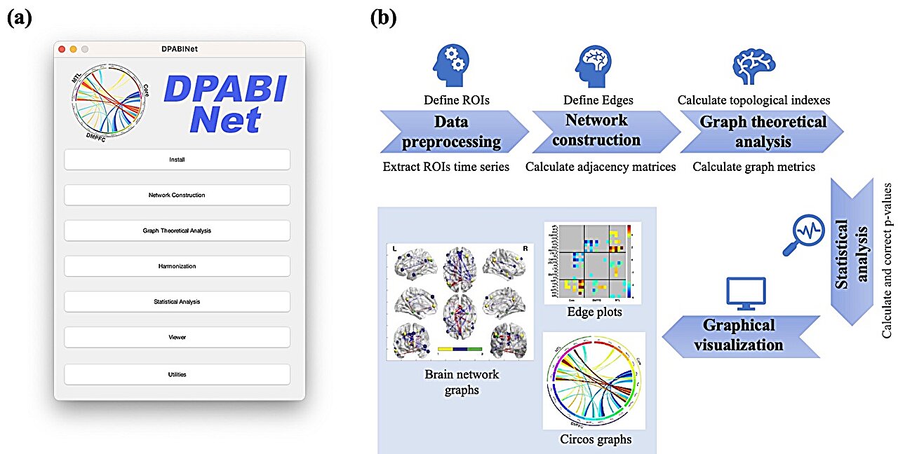 DPABINet: A turn - key brain network and graph theory analysis platform based on MRI data