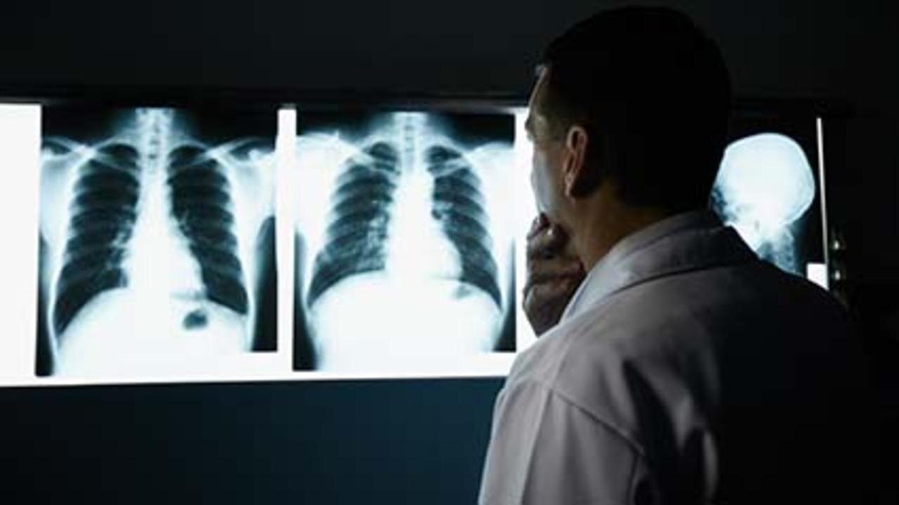 #FDA approves new drug for deadly lung cancer