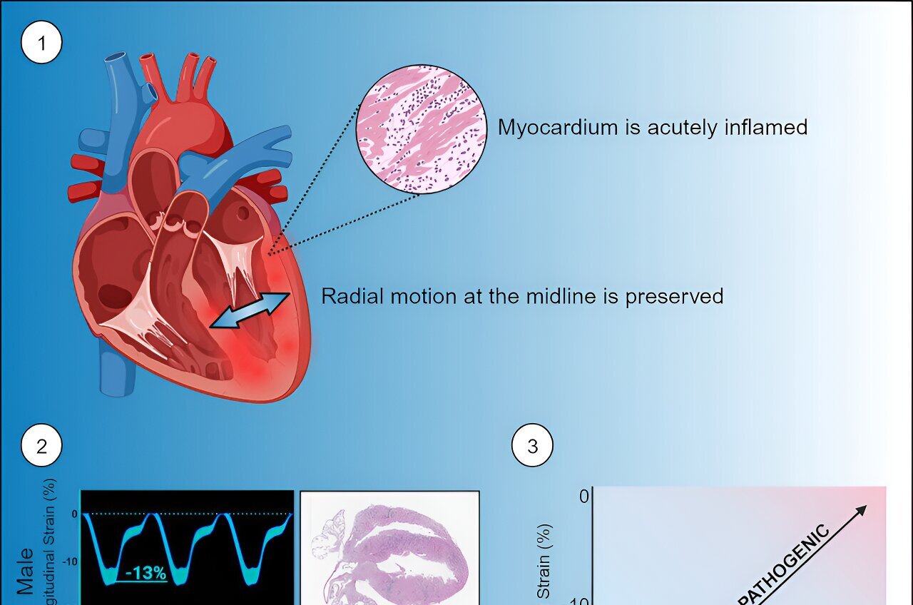 New Bioelectronic Mesh Can Grow with Tissues for Comprehensive Heart  Monitoring