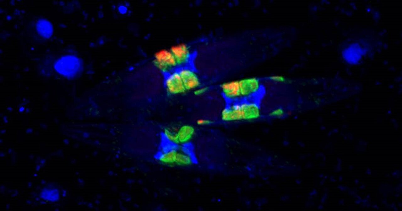 photo of New rhizobia-diatom symbiosis solves long-standing marine mystery image