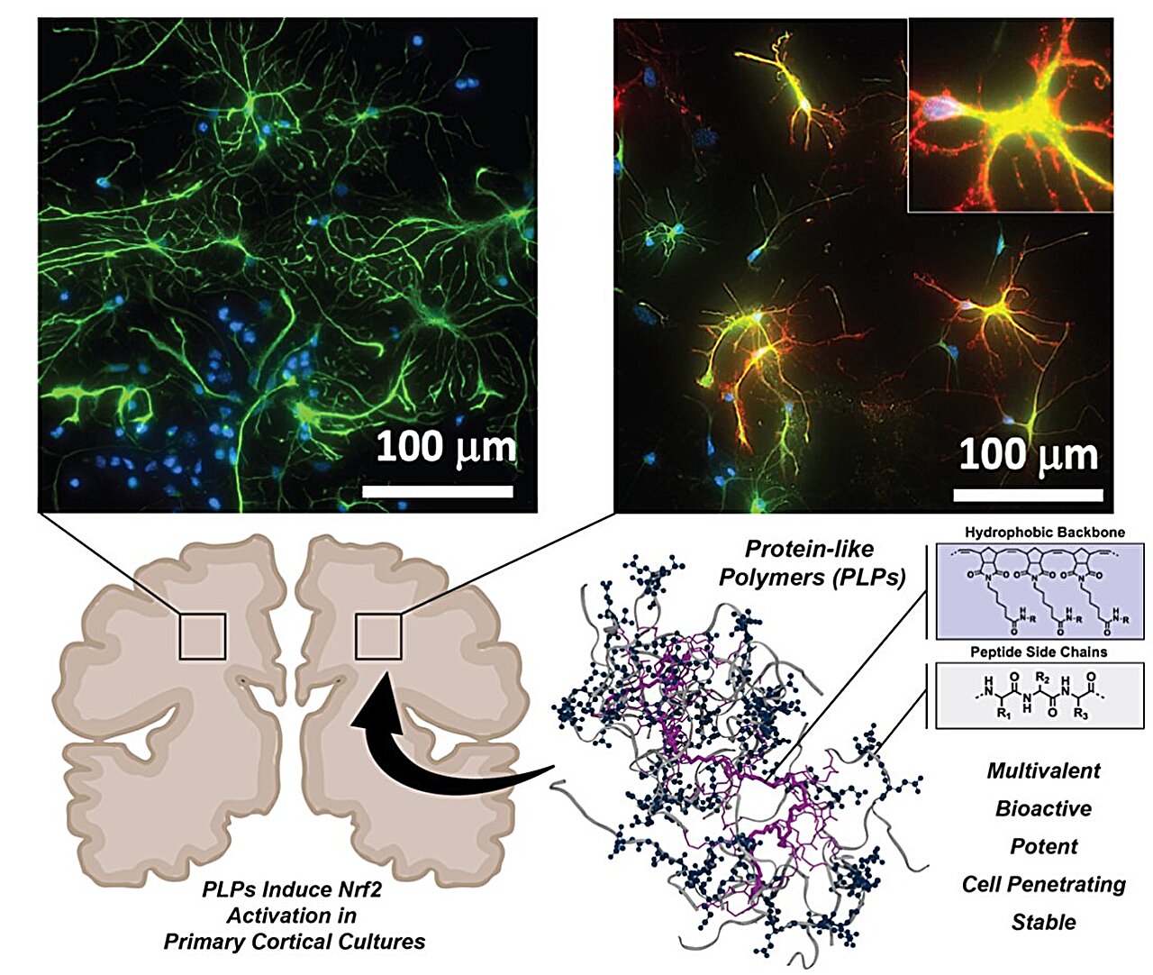 Targeting 'undruggable' proteins promises new approach for treating neurodegenerative diseases