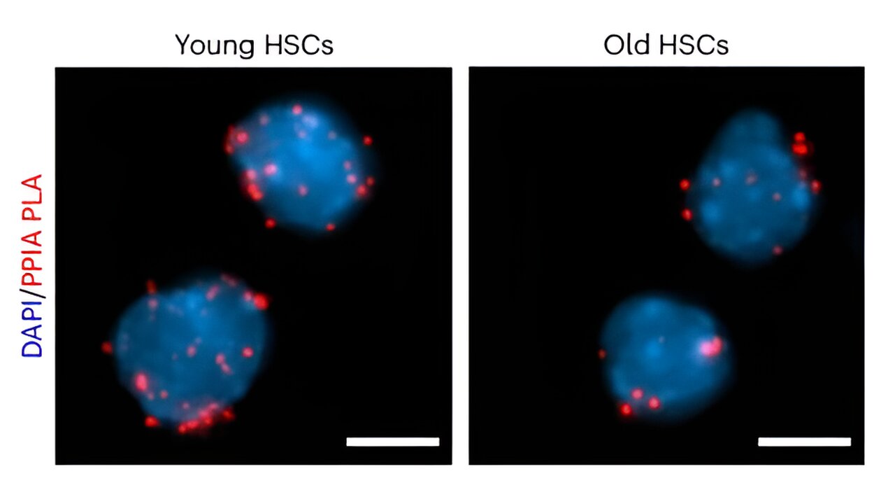 photo of Study uncovers the secret of long-lived stem cells image