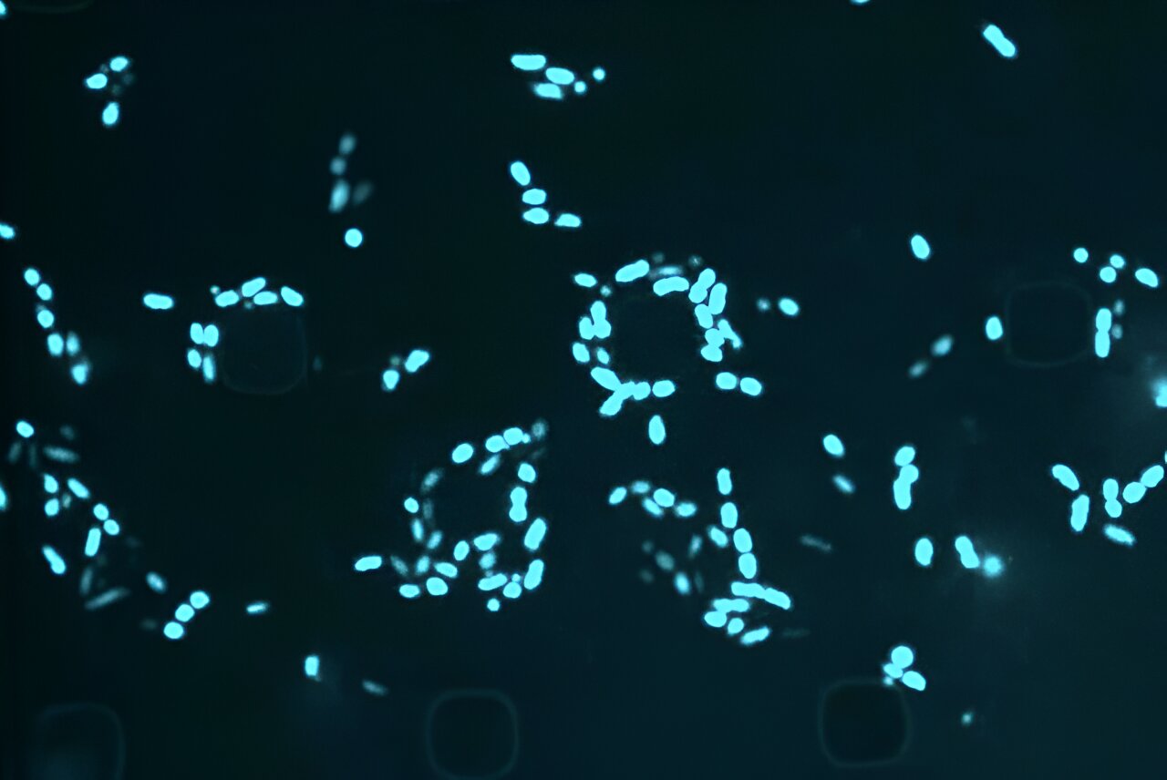 Scientists are using AI to target ‘sleeper’ bacteria