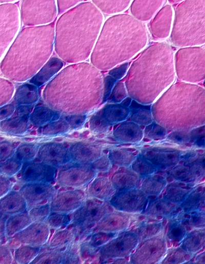 Stem cell surprise for tissue regeneration (w/ Podcast)