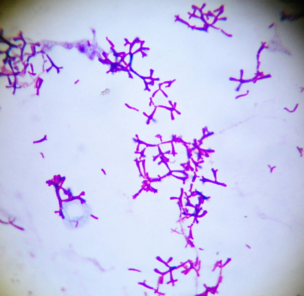 Микропрепарат бактерий. Микроскопия бифидобактерии бифидум. Bifidobacterium bifidum морфология. Bifidobacterium bifidum окраска по Граму. Бифидобактерии в мазке по Граму.