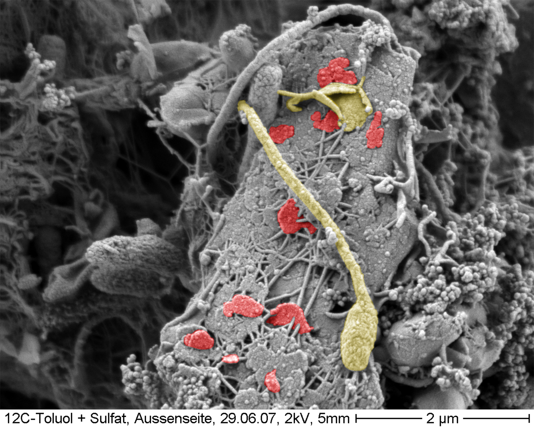 Инфекции в почве. Сапрофитные почвенные бактерии. Почвенные бактерии гниения. Почвенные микроорганизмы под микроскопом. Почвенные бактерии под микроскопом.