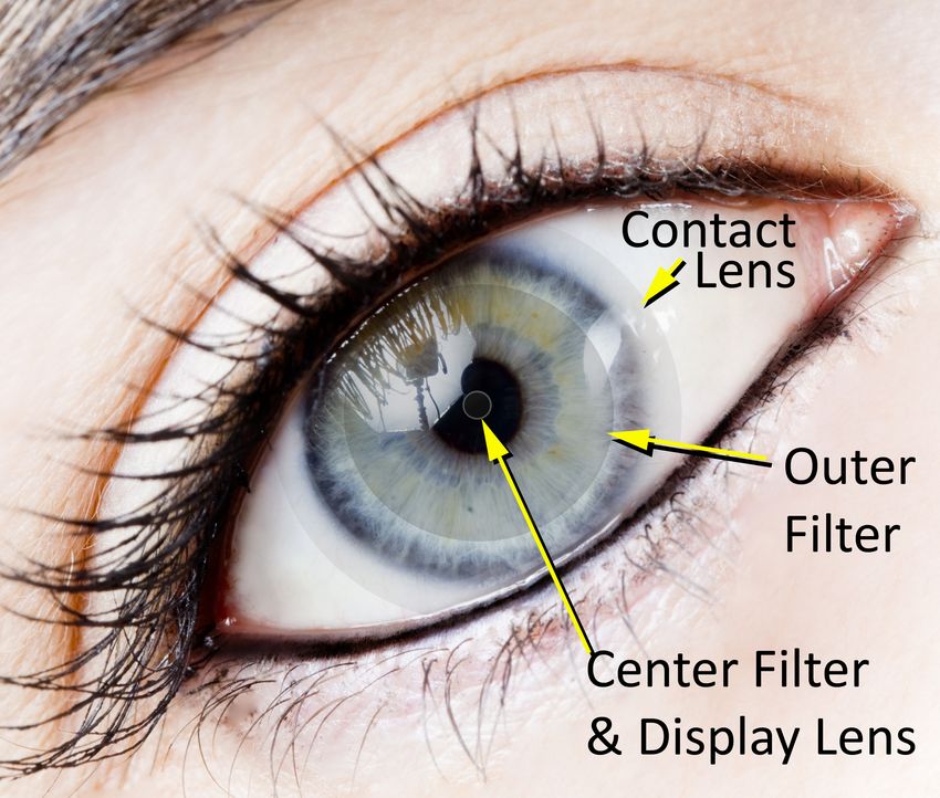 new contact lens designs