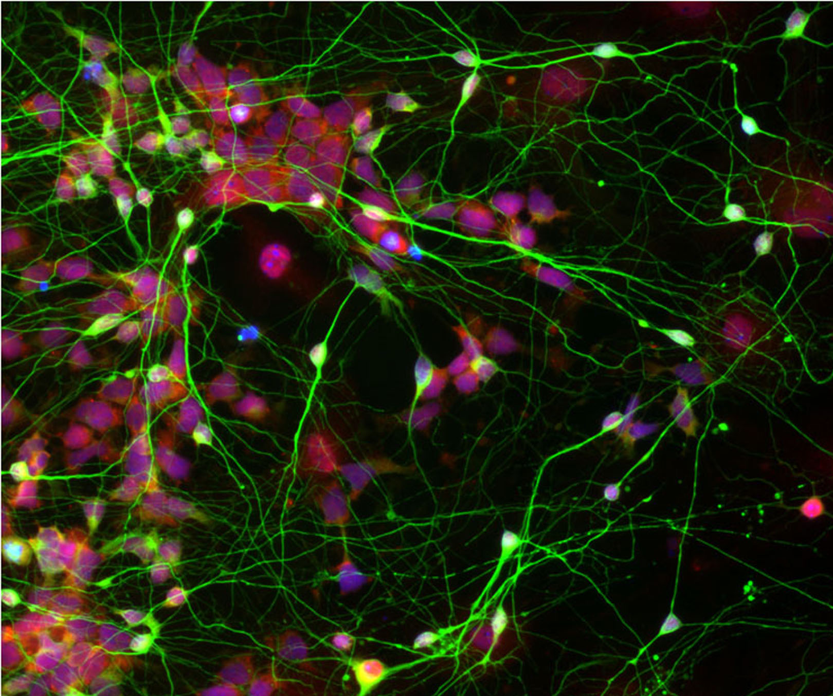 Как называются клетки головного мозга. Нейроны мозга под микроскопом. Нейральные стволовые клетки. Зеленые Нейроны. Нейронные связи головного мозга.