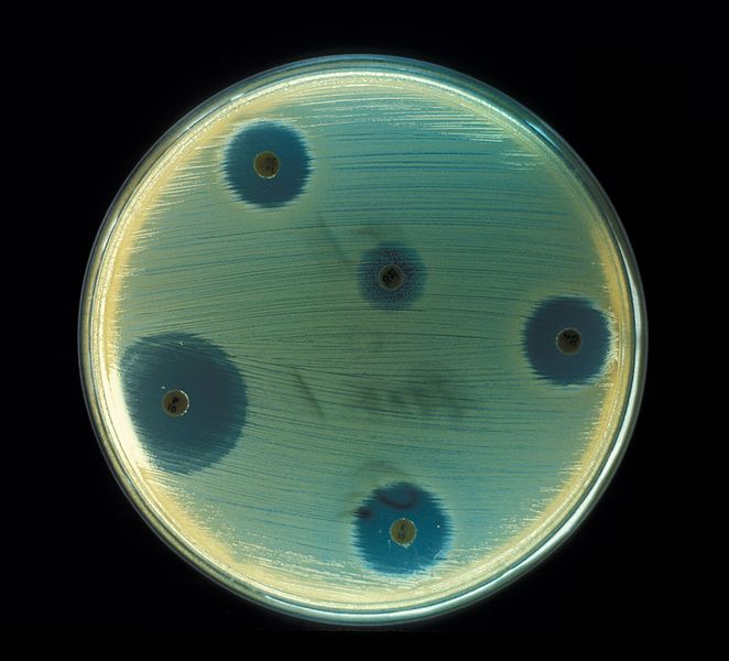 Premium Photo  Staphylococcus aureus antibiotic resistant bacteria