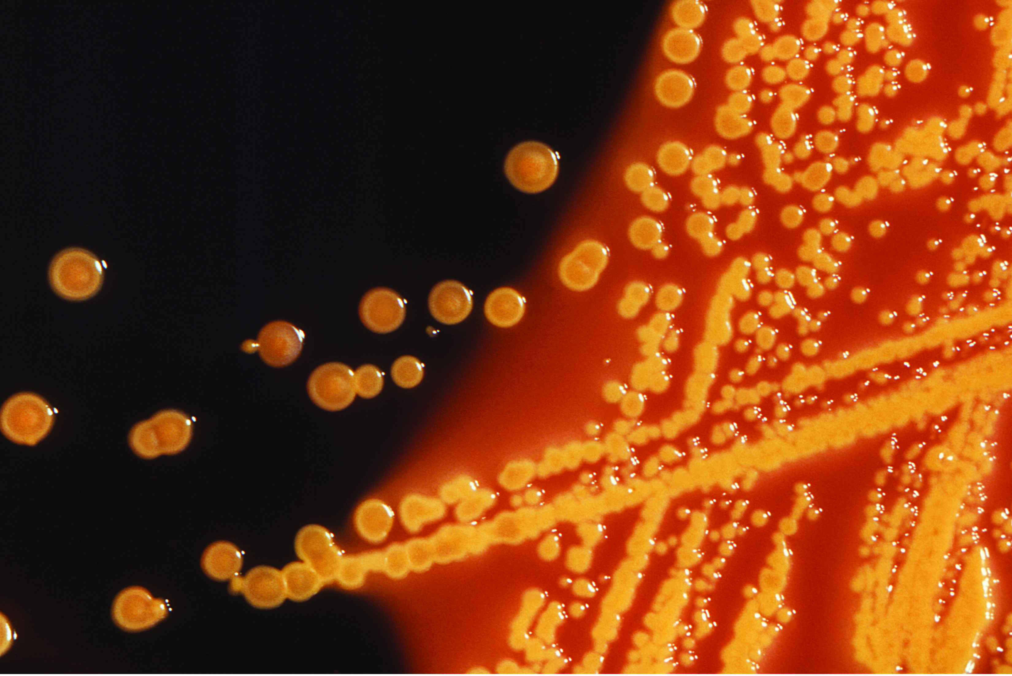 Желтые бактерии. Escherichia coli колонии. Оранжевые бактерии. Оранжевые колонии бактерий. Микроб оранжевый.