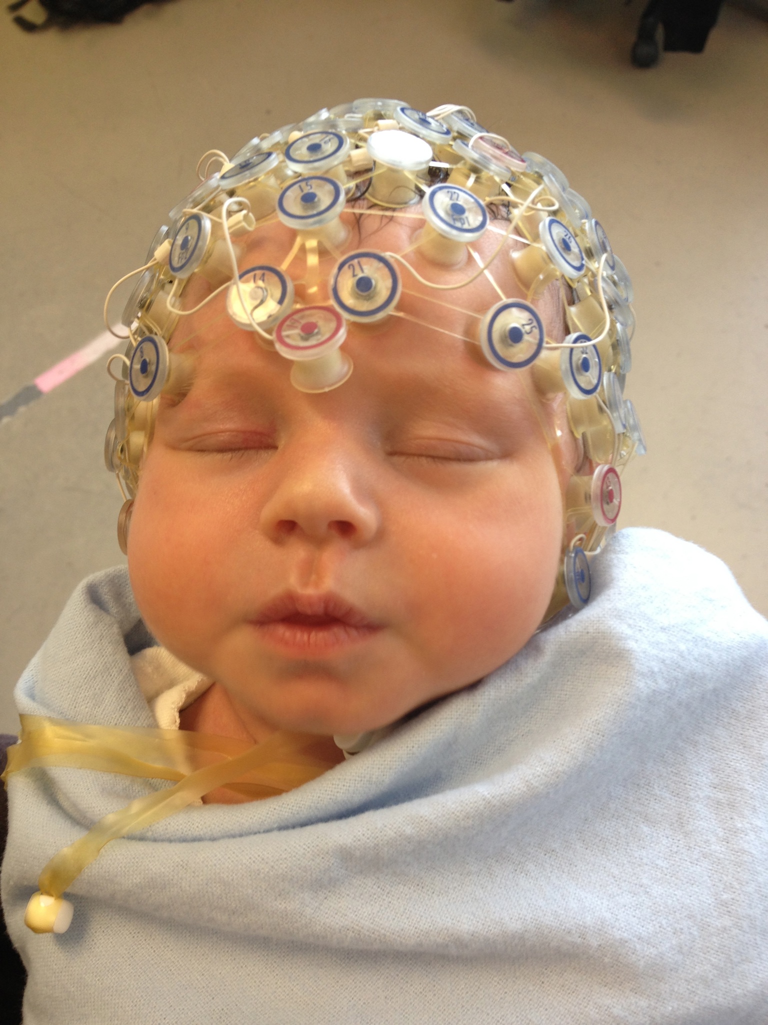 Ээг головы ребенку. ЭЭГ. Электроэнцефалограмма головного мозга. Энцефалограмма головы. Электроэнцефалография у детей.