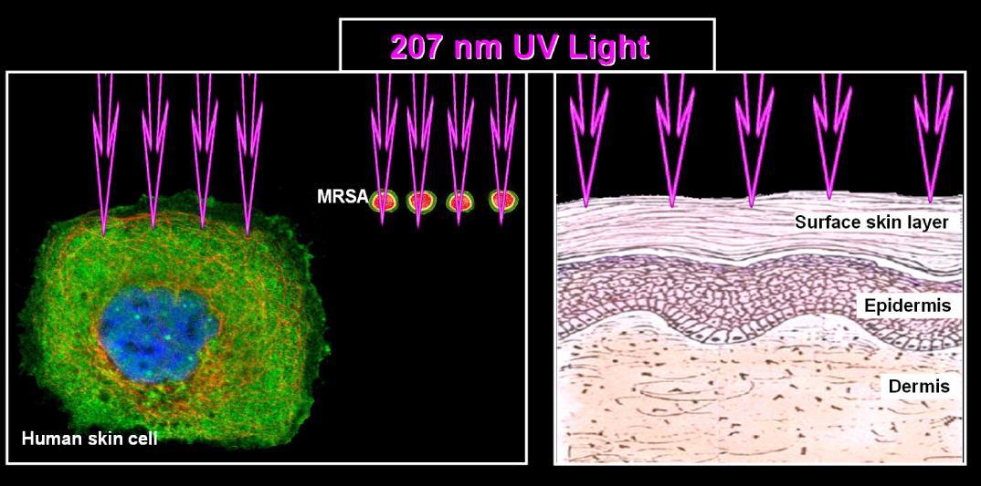 Can UV light damage human cells?