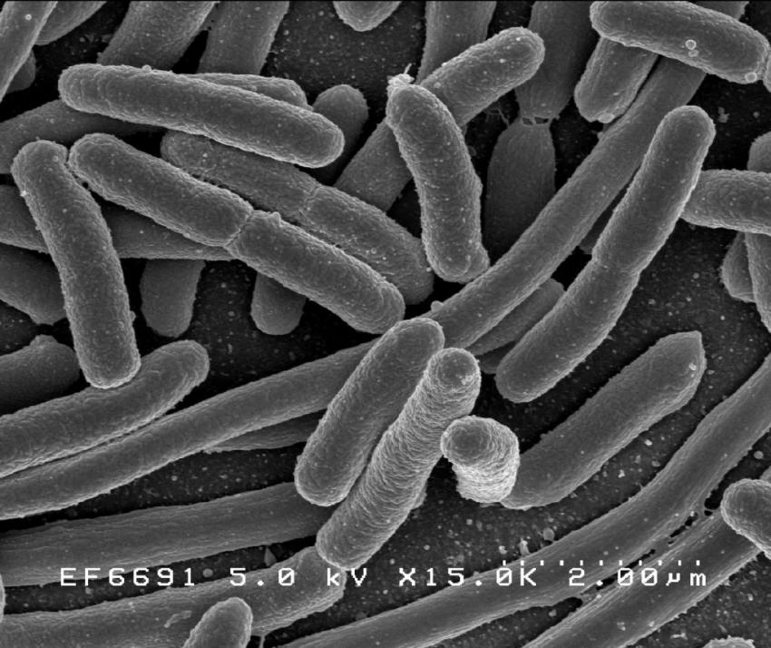 Poor toilet hygiene, not food, spreads antibiotic-resistant E. coli superbugs - Medical Xpress thumbnail