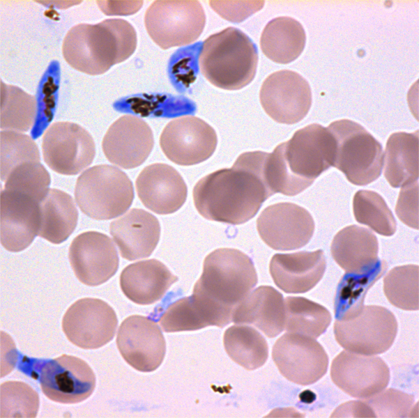 Малярия клетки. Малярийный плазмодий фальципарум. Малярийный плазмодий falciparum. Малярийный плазмодий в эритроцитах крови. Мерозоиты Plasmodium falciparum.