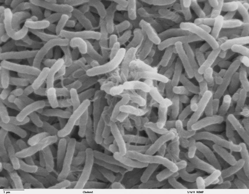 #Persistent strain of cholera defends itself against forces of change, scientists find