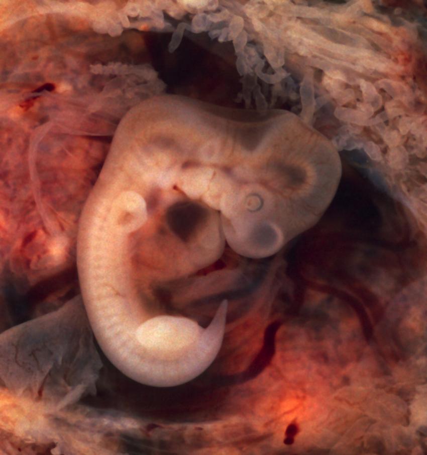 Researcher proposes a new definition of a human embryo from a legal perspective