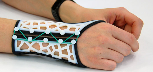 These 3D Printed Arthritis Assist Tools Aim to Make Living with Arthritis  Less of a Burden 