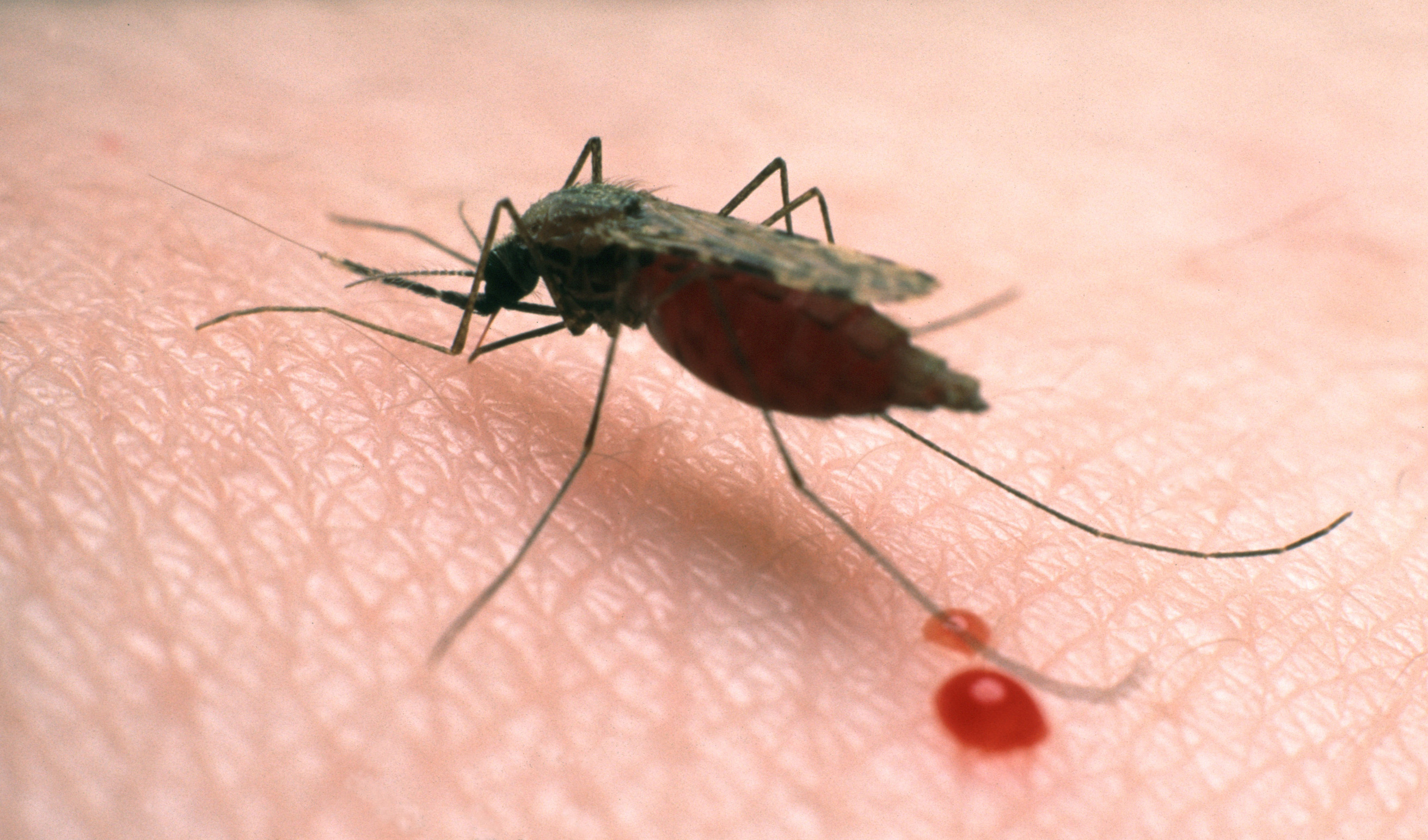 Малярия в домашних условиях. Укус малярии малярийный комар. Как выглядит укус малярийного комара. Укус марелильного Камара.