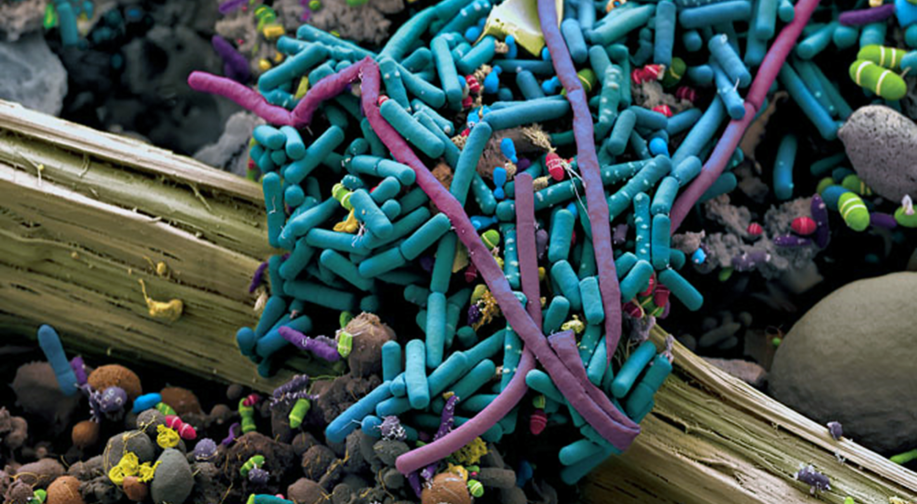 Жива культура бактерии. Микробы и бактерии под микроскопом. Бациллы бактерии под микроскопом. Эубактерии под микроскопом. Микроорганизмы под микроскопом.