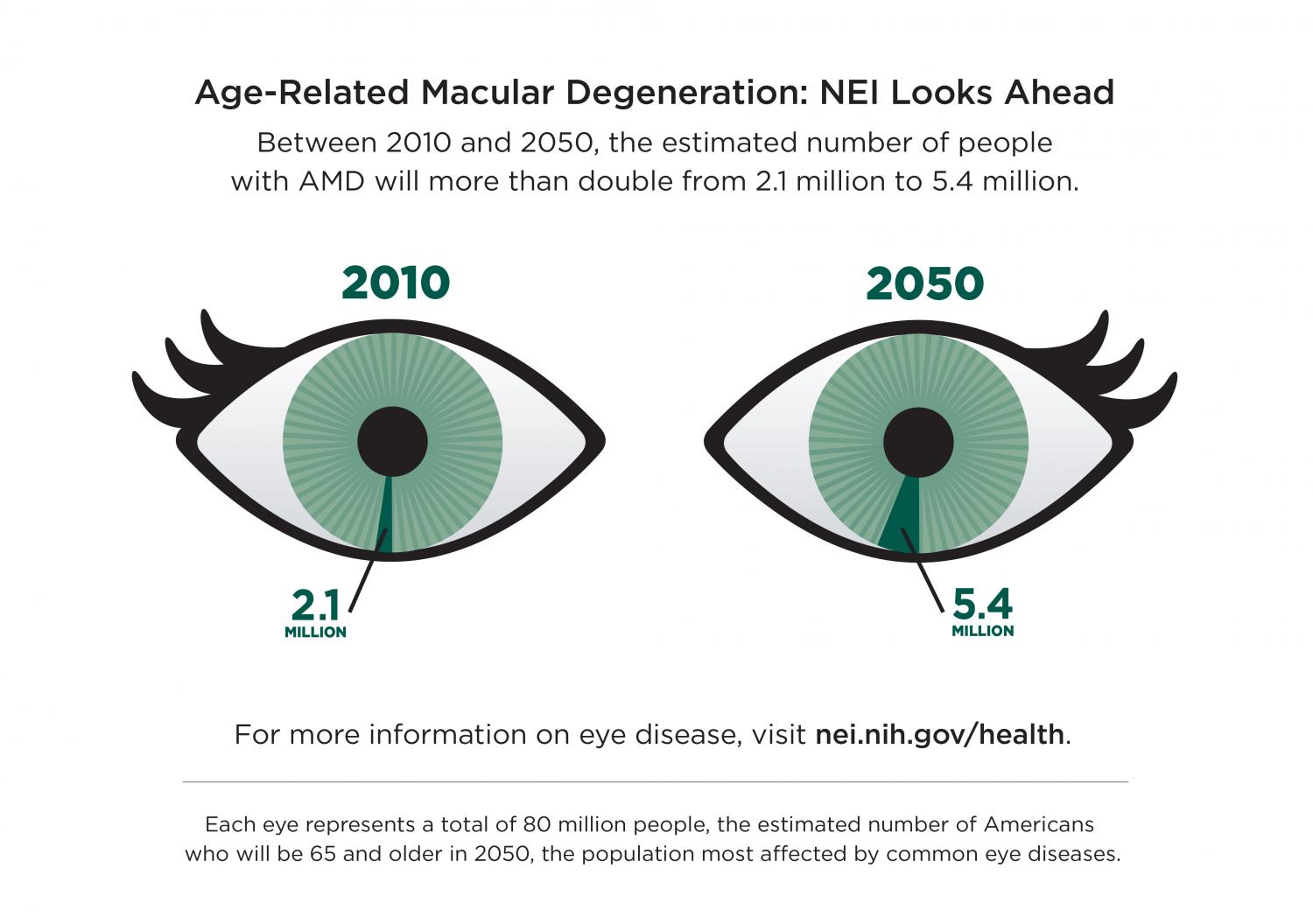 Inflammation-reducing drug shows no benefit for dry age-related macular  degeneration in NIH trial