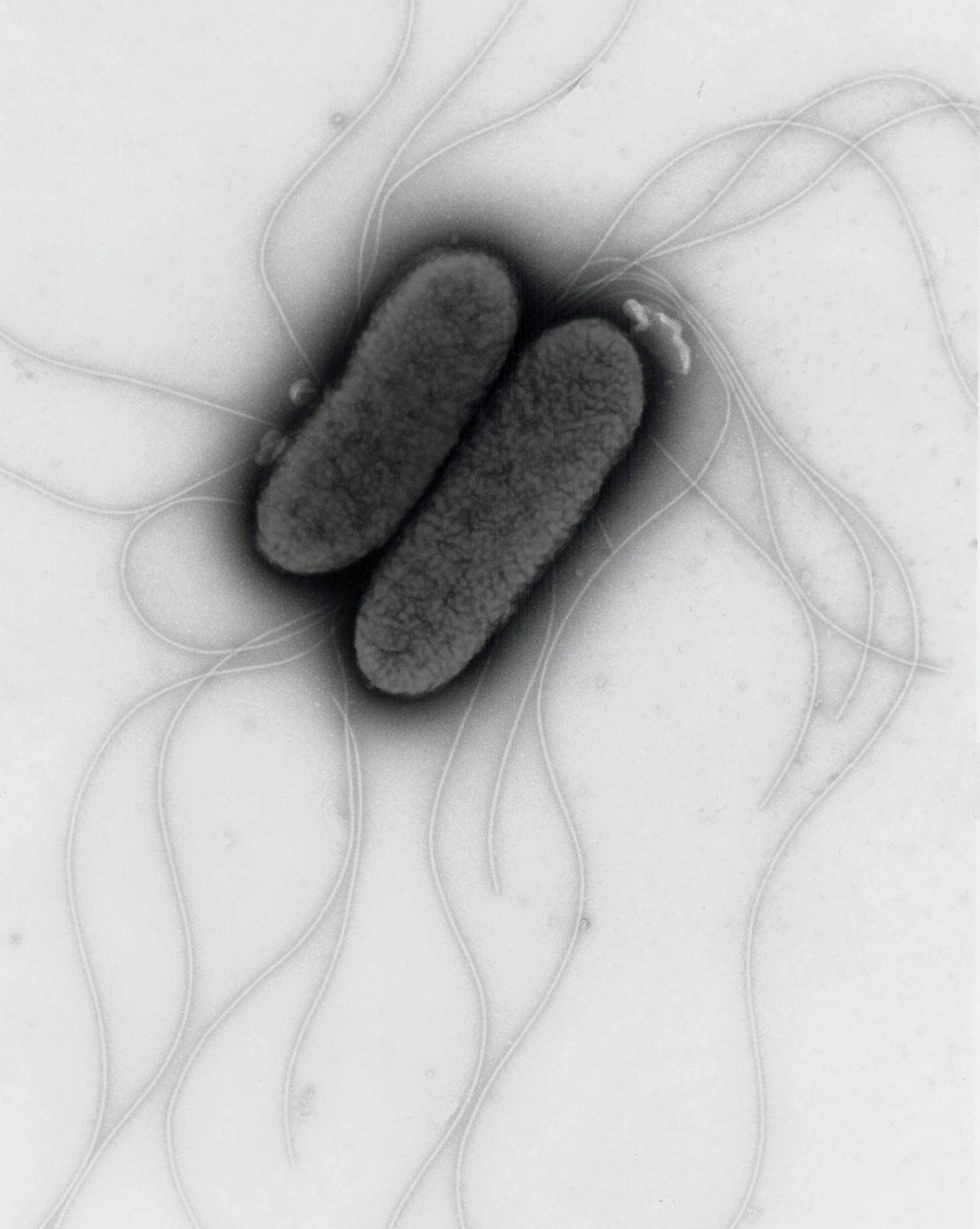 Сальмонеллез бактерия. Бактерия сальмонелла Тифи. Сальмонелла тифимуриум. Сальмонелла — бацилла.