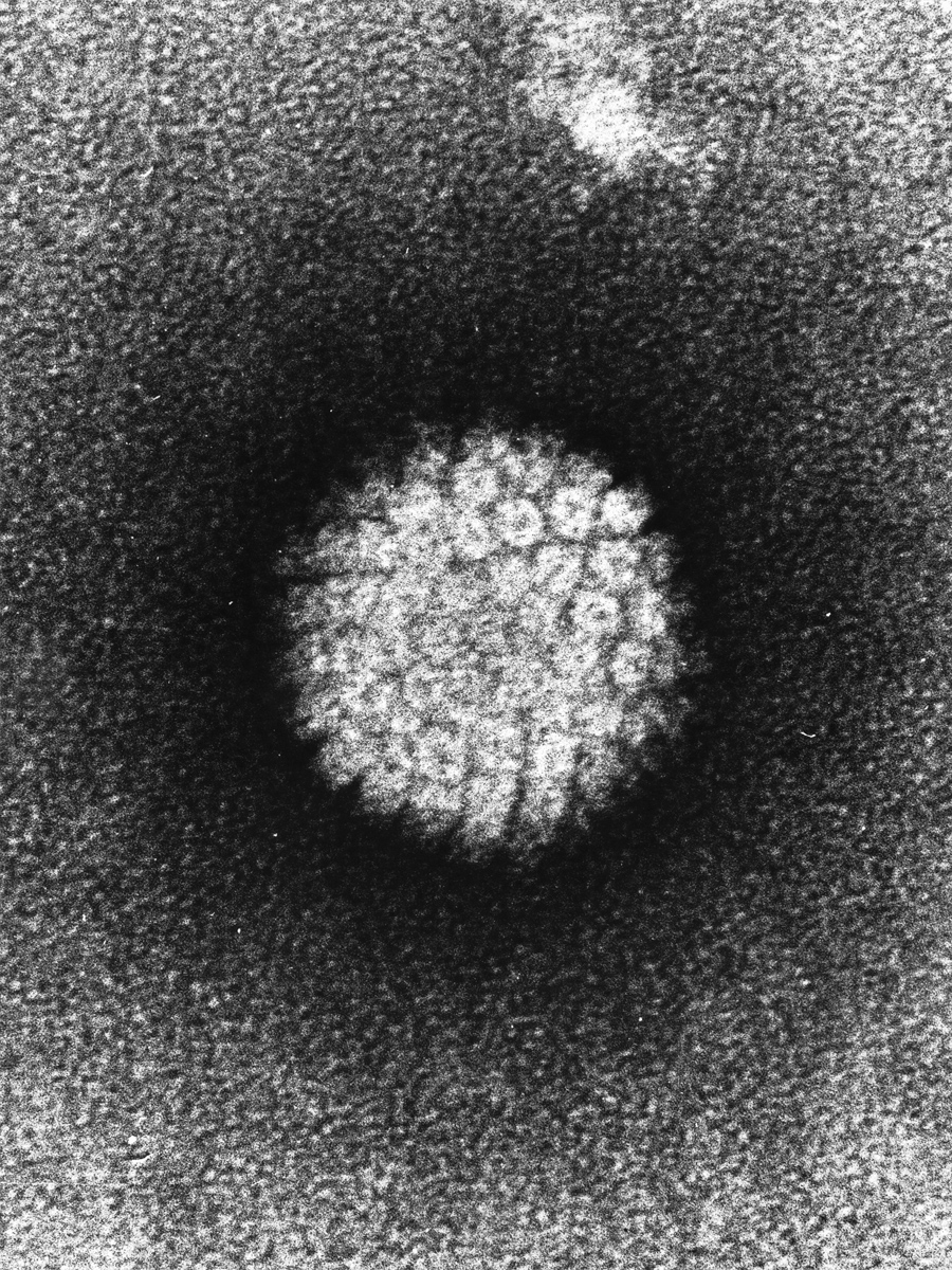 #Military veterans face increased risk of HPV-related cancer due to low vaccination rates