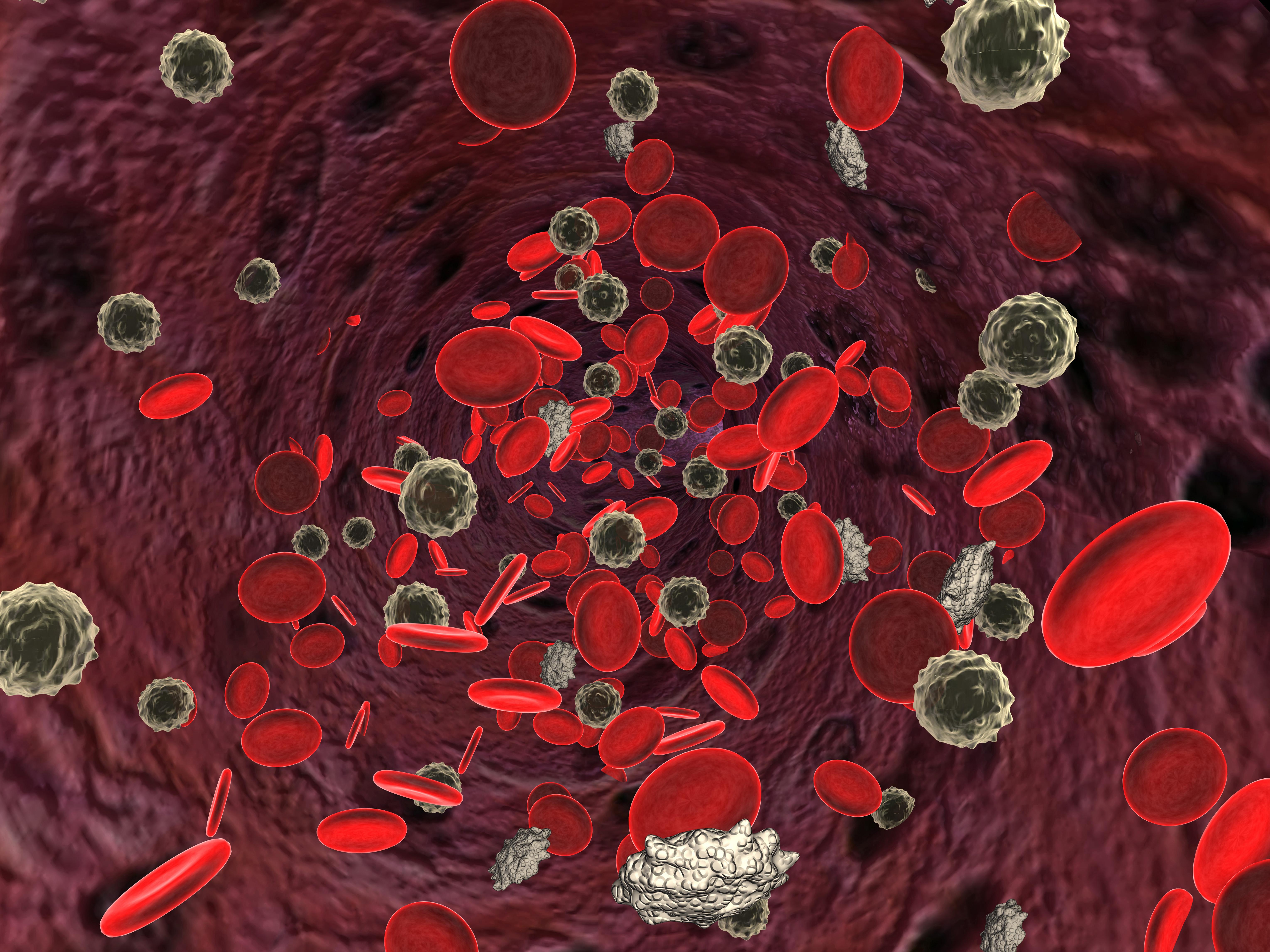Анемия 2022. Болезни системы крови. Заболевания системы кроветворения. Клетки крови.