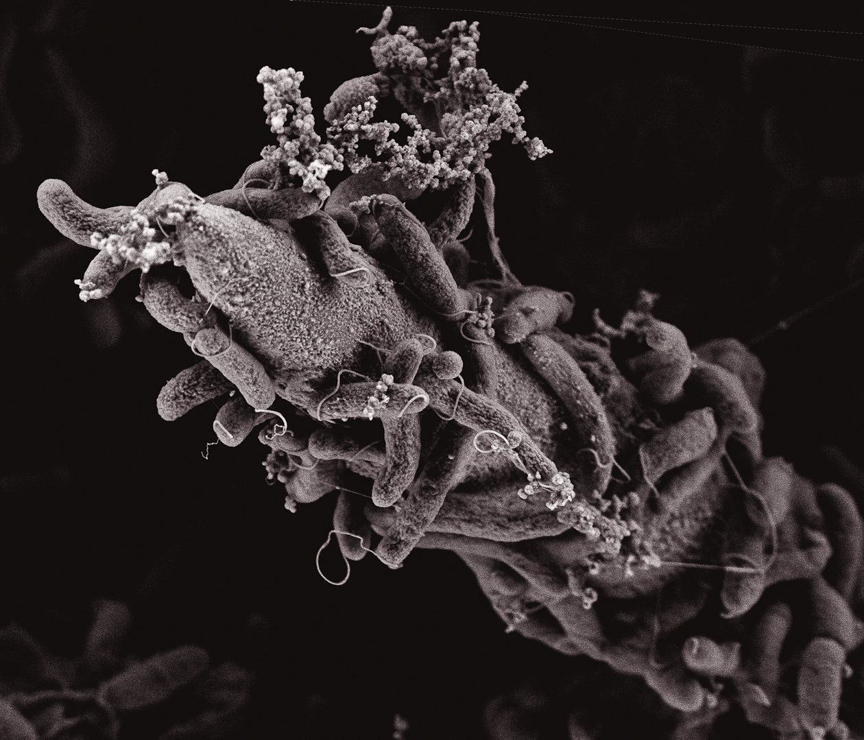 Бактерии домашних условиях. Холерный вибрион в микроскопе. Микроб холеры под микроскопом. Вибрион холеры под микроскопом. Vibrio cholerae микроскопия.
