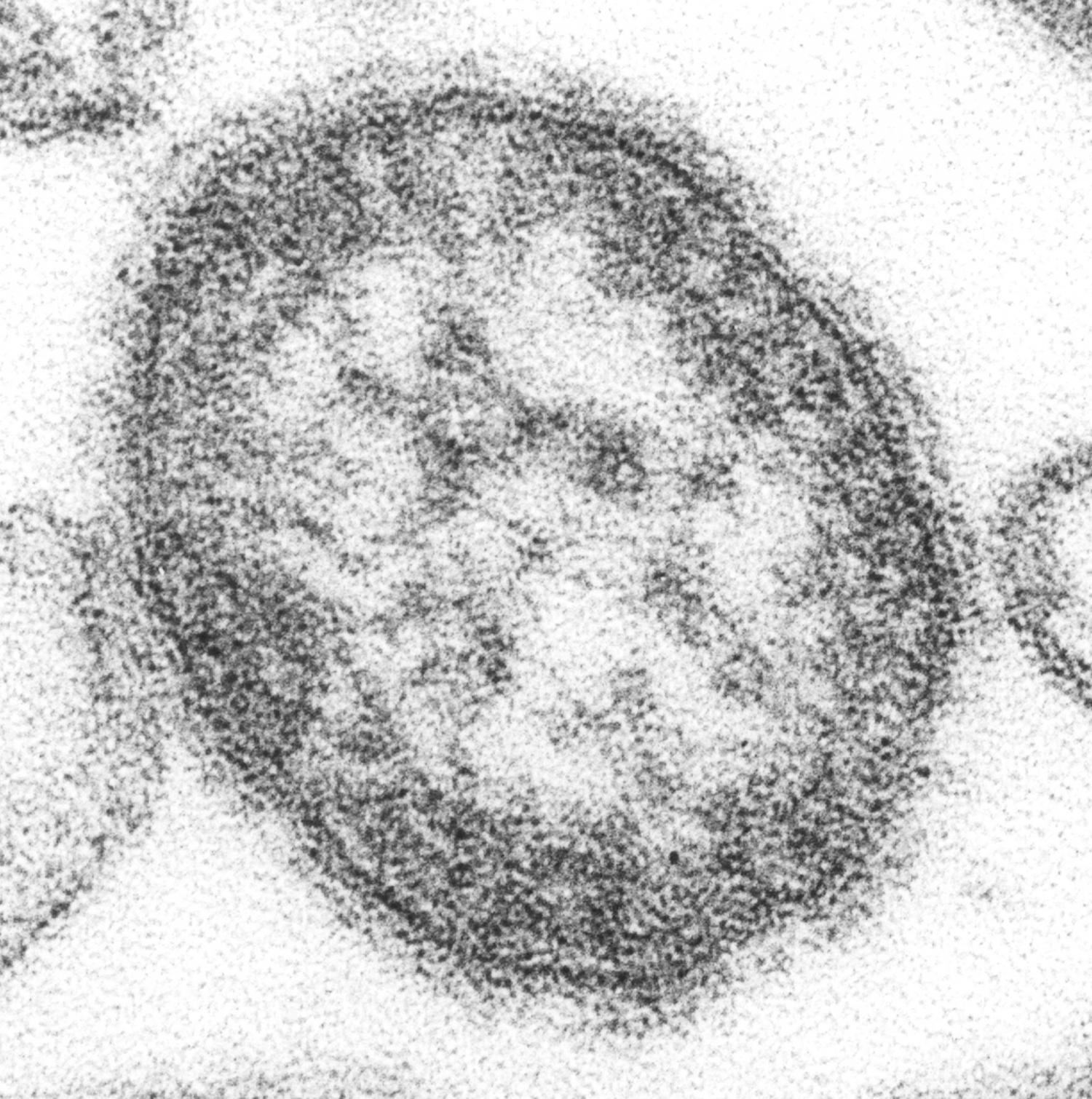 #experts fear Balkans measles outbreak