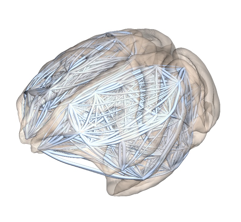 Large brain. Мозг нейросеть. Нейронные связи мозга фото стильно. Логотип на тему о мозге. Art Exhibition Brain.