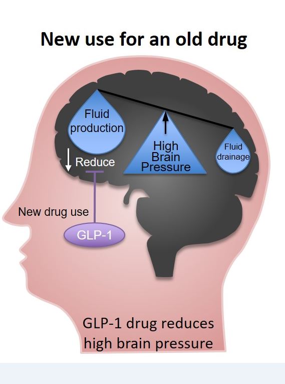 High brains. Монитор внутричерепного давления Brain-Pressure. Translational research drug. Science Focus the productive Brain.