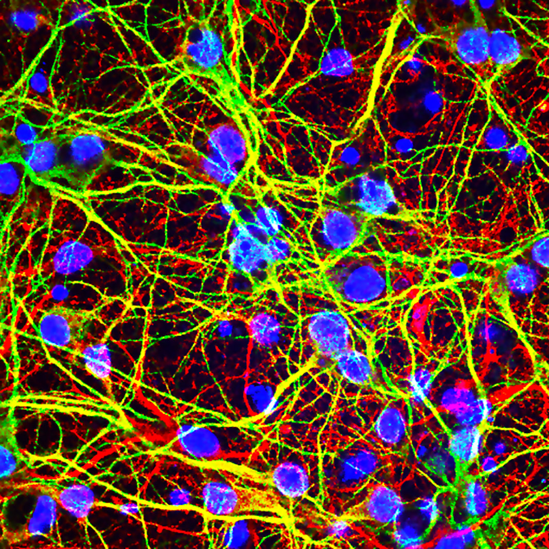Образование клетки мозга. Нейронная клетка. Клетки мозга под микроскопом. Нейроны головного мозга. Нейронные клетки головного мозга.
