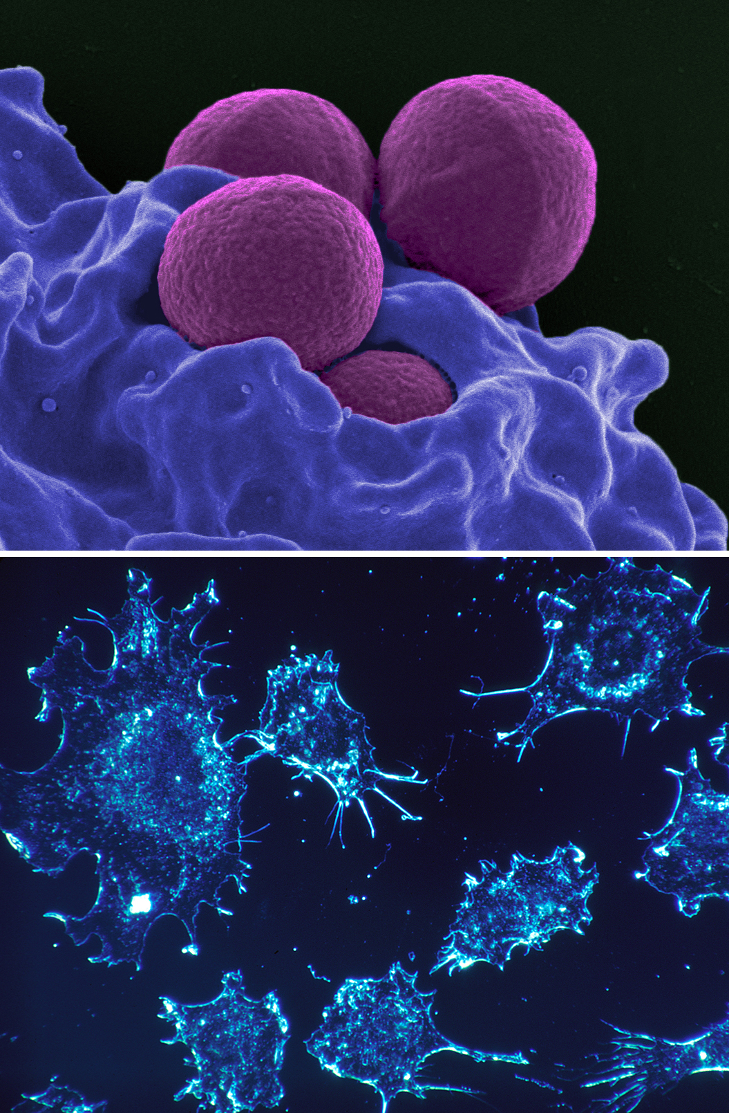 Резистентность клетки. Бактериология. Бактериология картинки для презентации. Резистентность капилляров. Cancer bacteria.