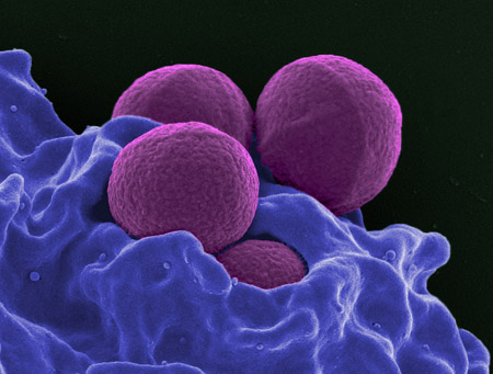 How superbugs use mirror images to create antibiotic resistance