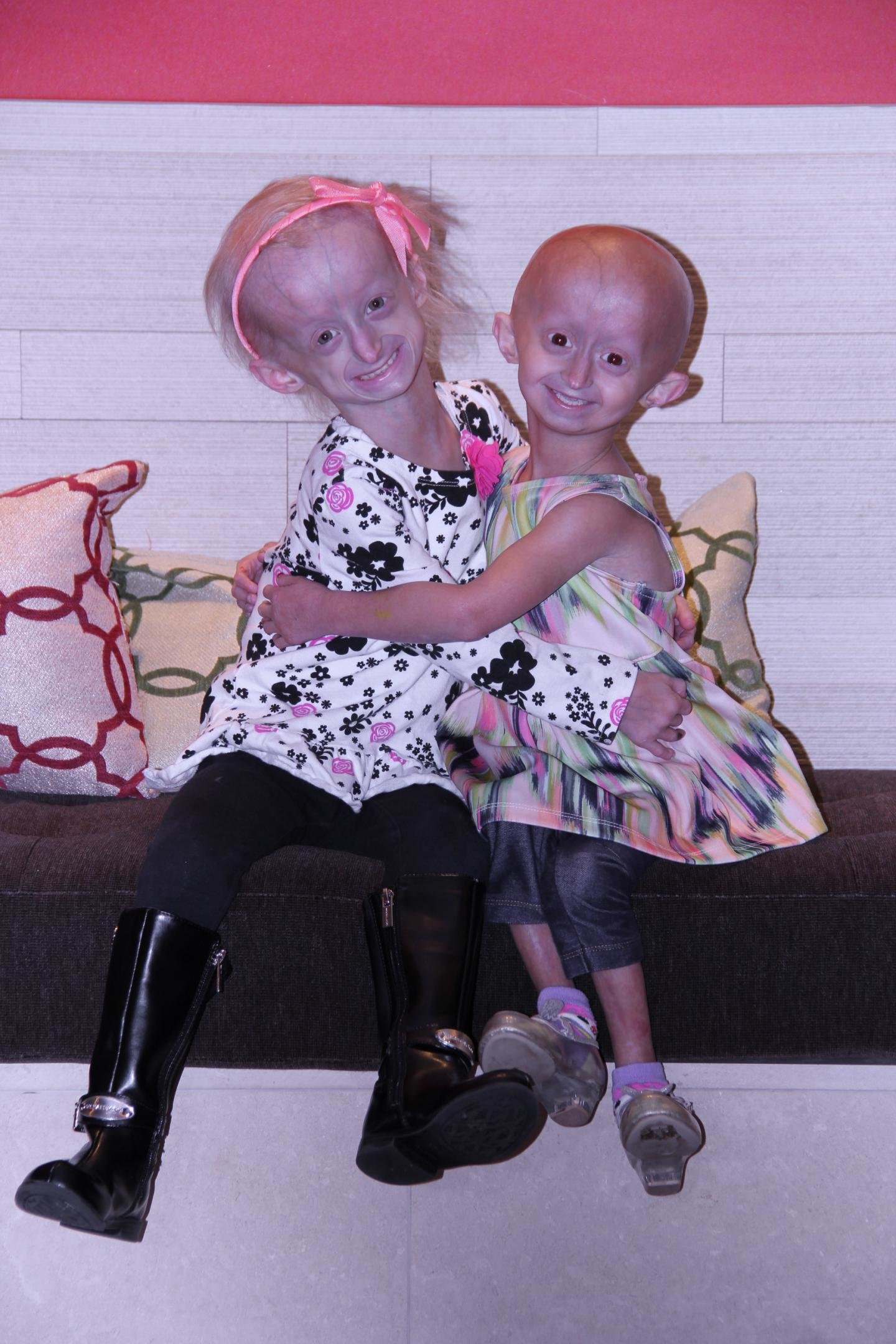 Experimental Drug Extends Survival In Progeria