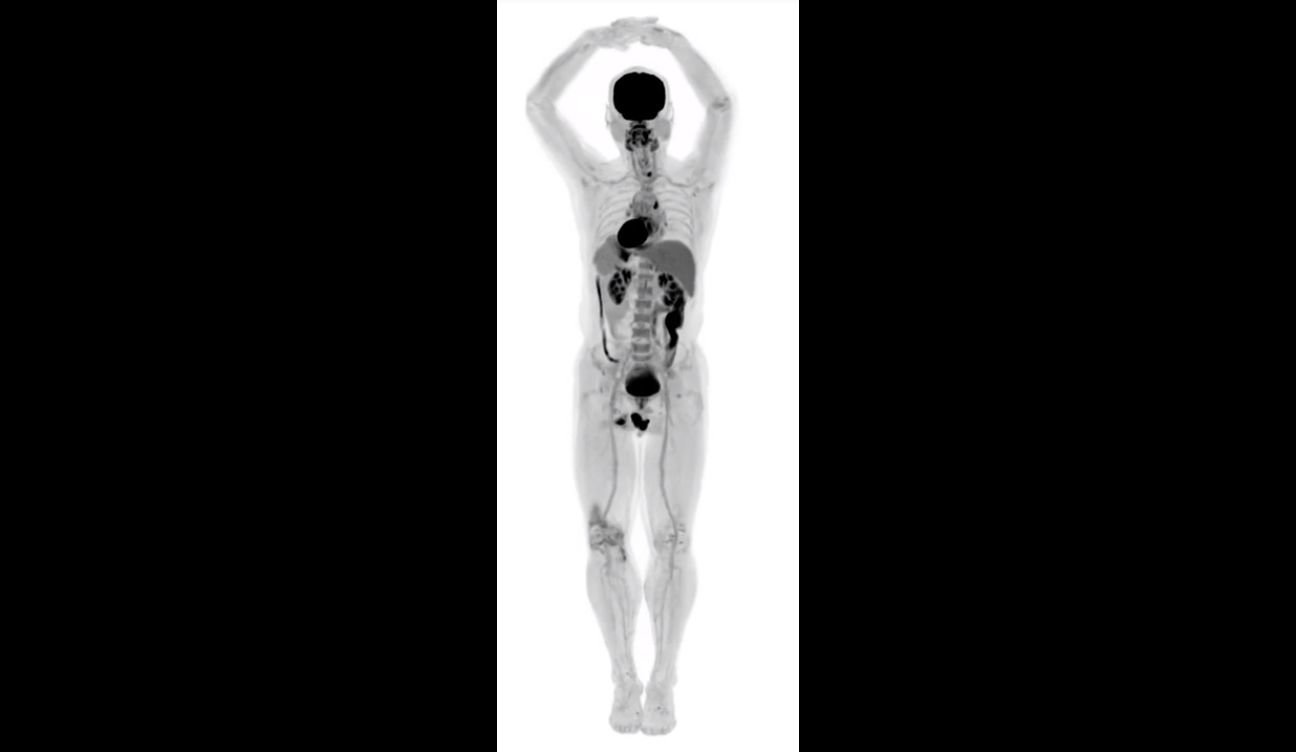 Full body scanner - Wikipedia