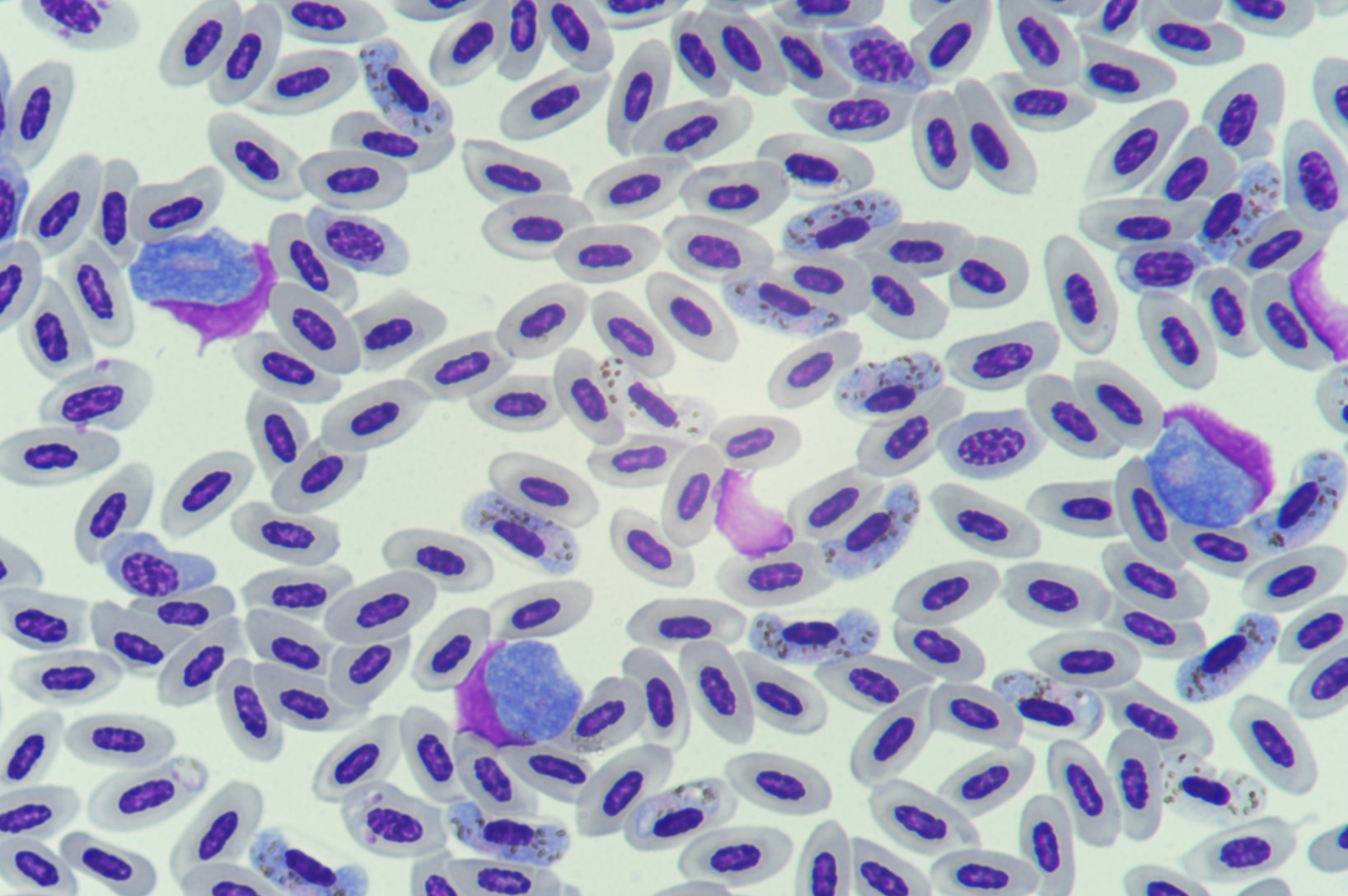 Дерево малярия. Plasmodium malariae under Microscope. Лекарство в микроскопе. Malarial Plasmodium under Microscope. A microscopic image of Plasmodium parasites.