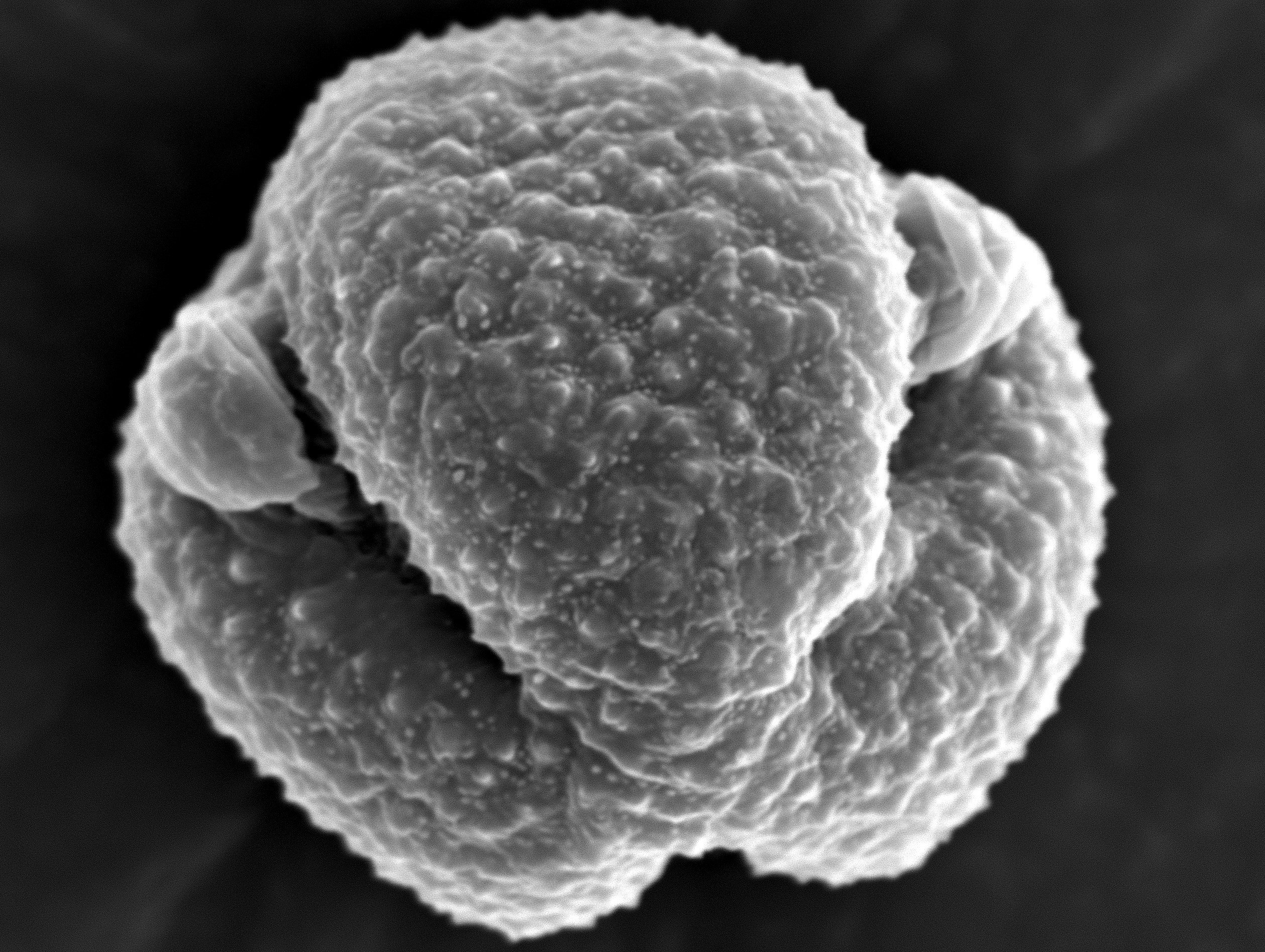 Гены пыльцы. Пыльца полыни под микроскопом. Полынь под микроскопом. Пыльца растений под микроскопом. Артемизия пылинка под микроскопом.