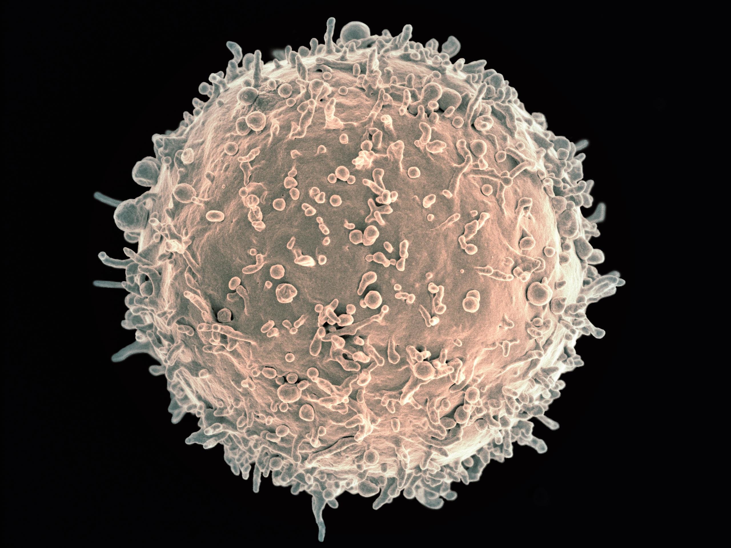 Т и б клетки. Т лимфоциты под микроскопом. B лимфоциты под микроскопом. Клетки b и т лимфоциты. B-клетки в b лимфоциты.