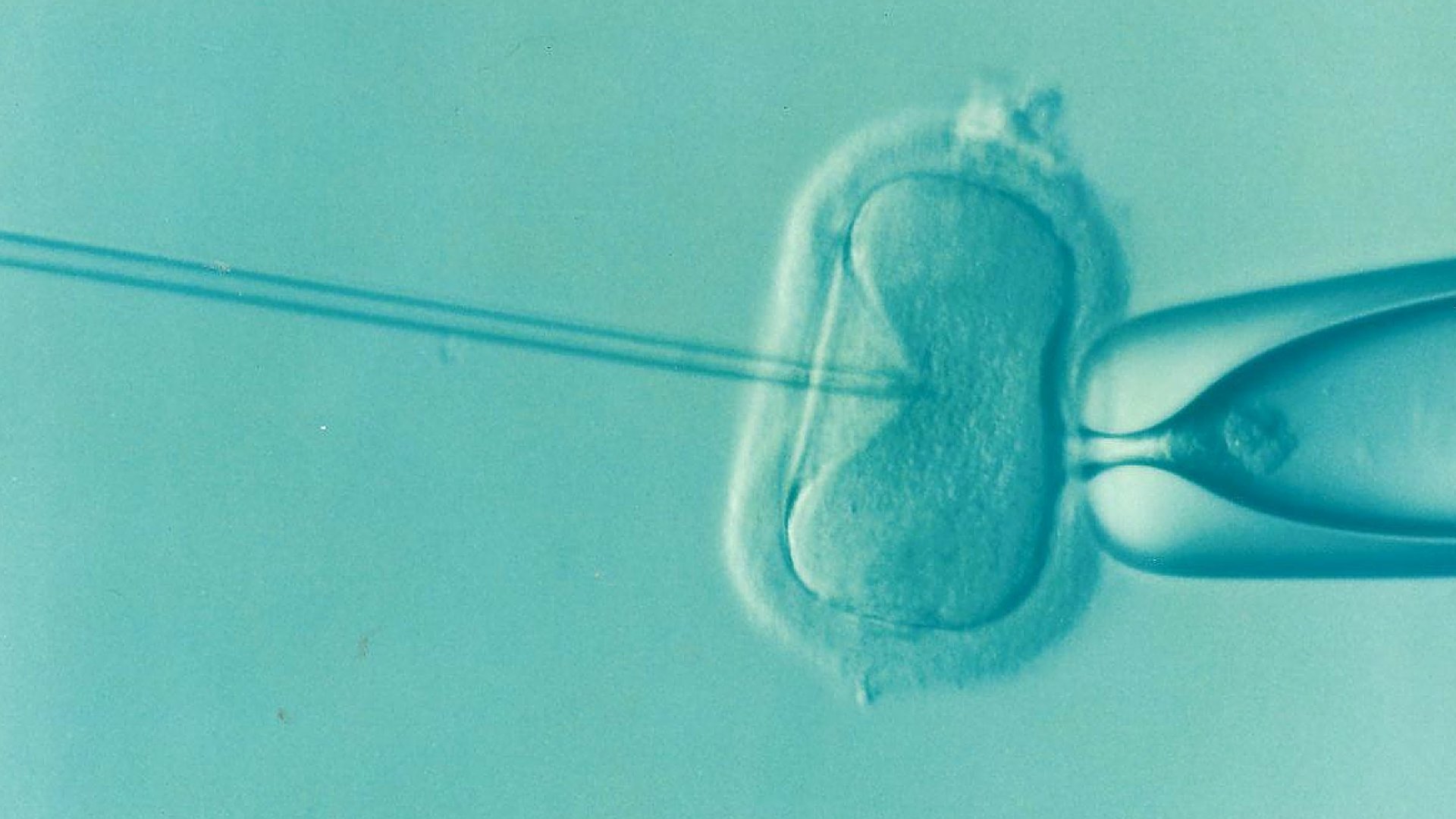 Home-monitoring during IVF found to work just as well as hospital checks