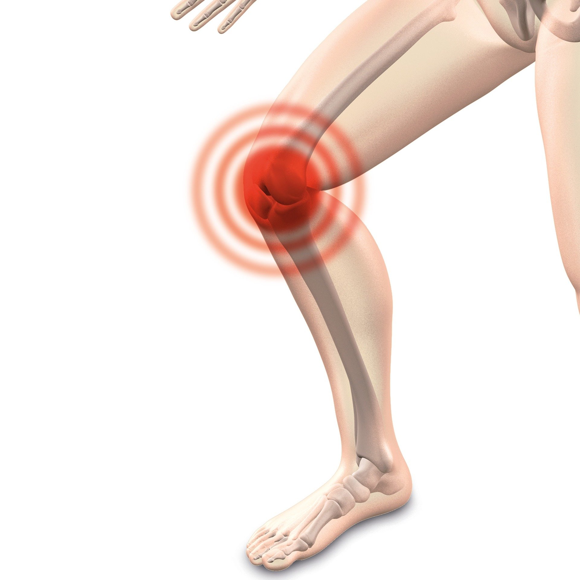 ovarian cancer knee pain)