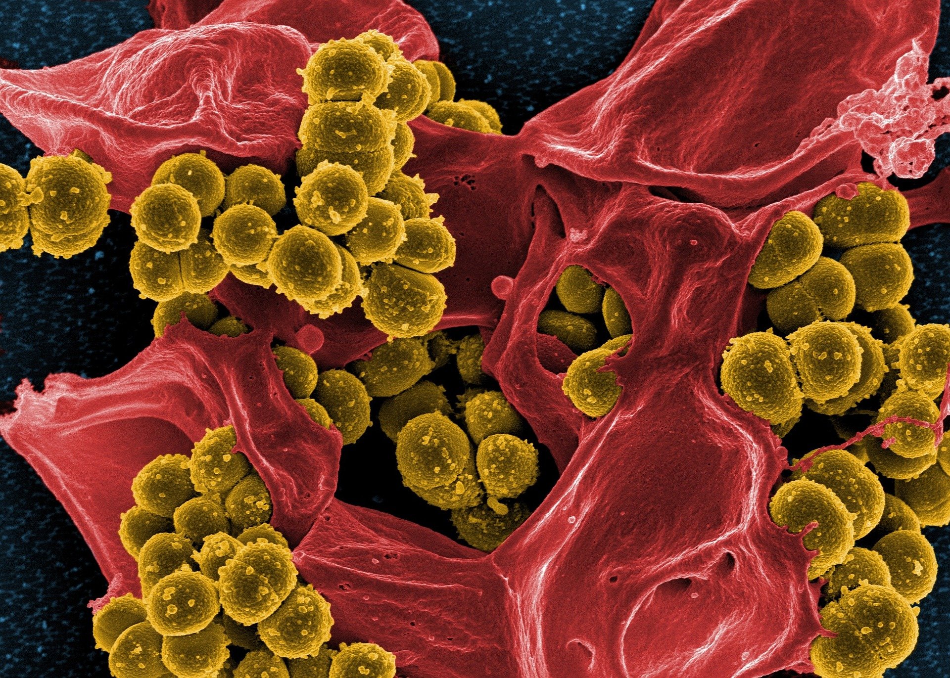 Study reveals how naturally-occurring compound kills major drug-resistant bacter..