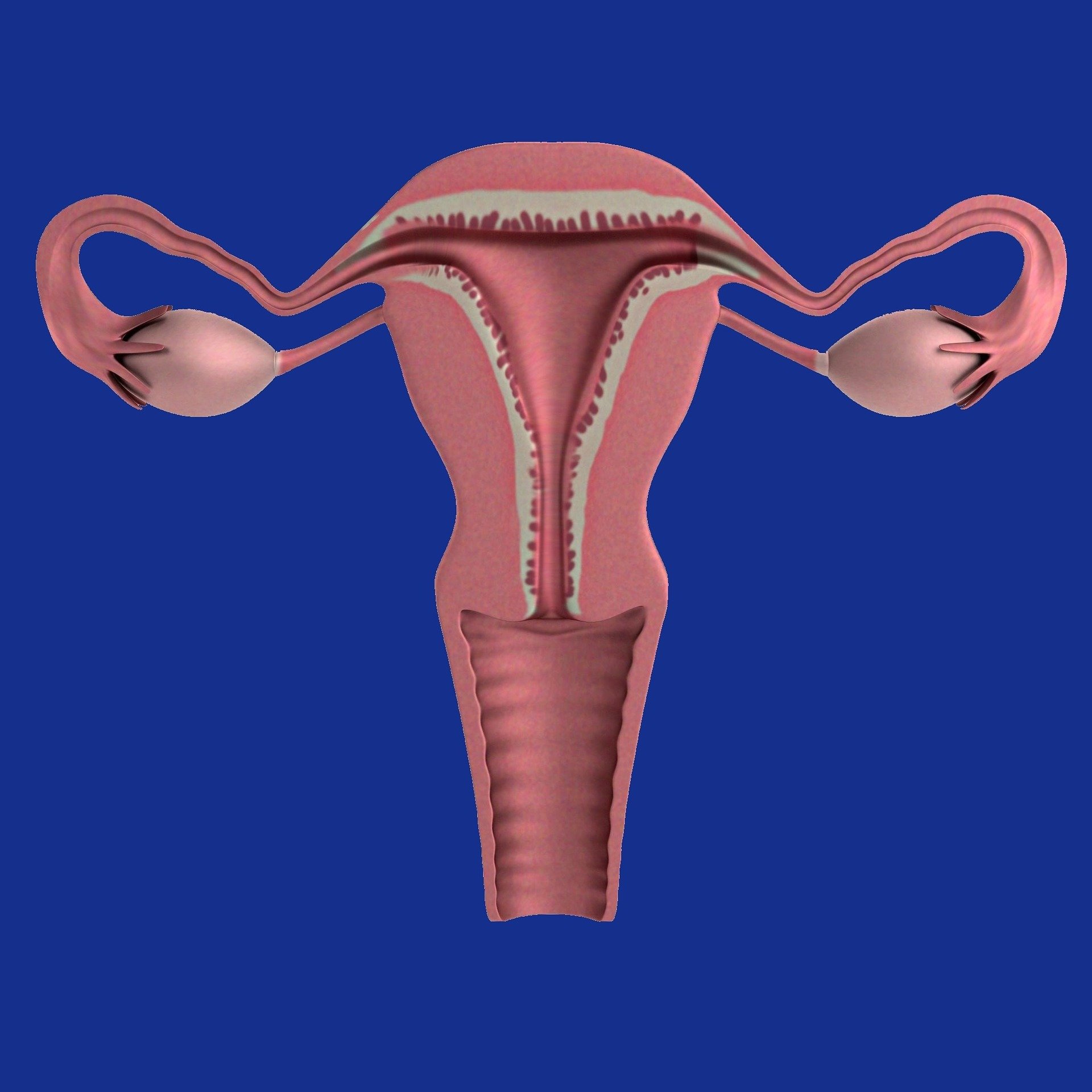 Less Surveillance Needed For Simple Ovarian Cysts