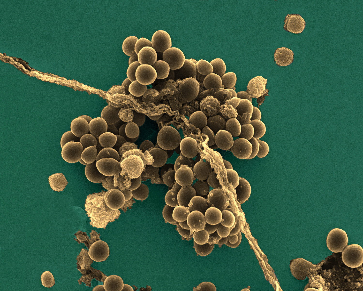 Стафилококк ауреус. Стафилококк сапрофитикус. Золотистый стафилококк под микроскопом. Стафилококк ауреус под микроскопом. Бактерия золотистый стафилококк.