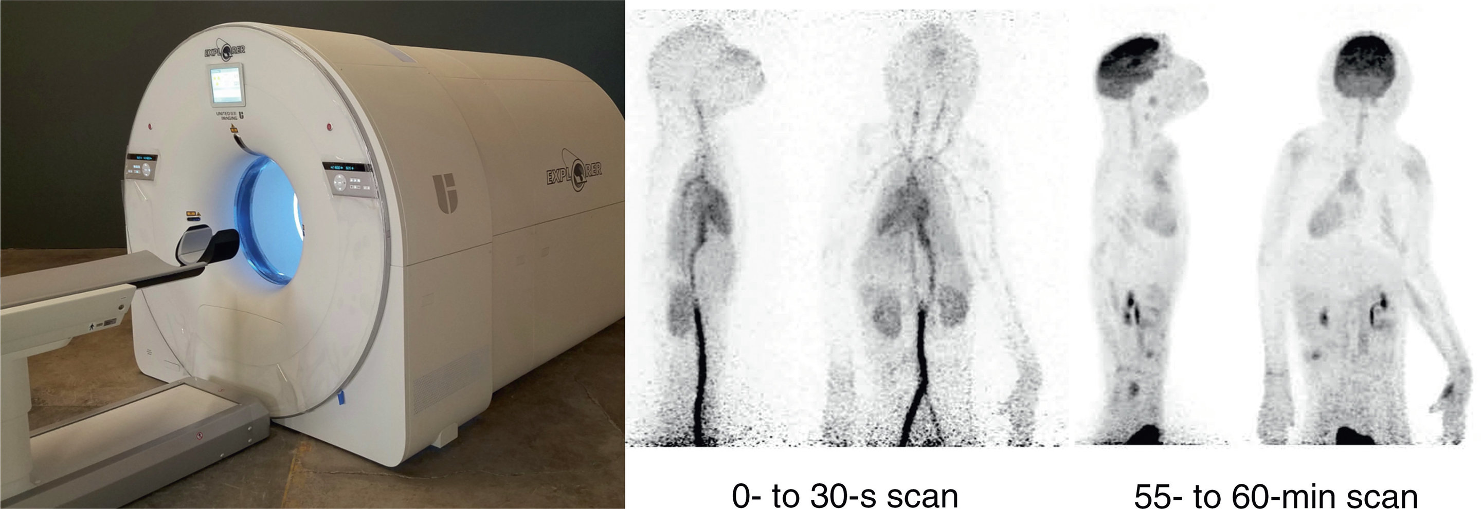 Advancing Whole-body Dynamic PET Imaging for Understanding Disease