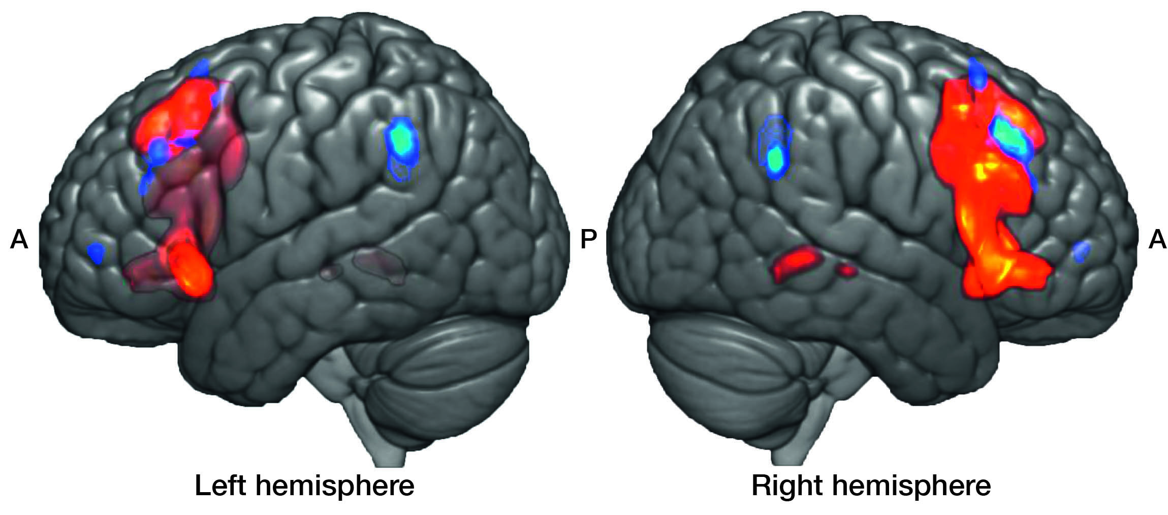 Brain 23. Left Hemisphere. Music and Brain. Homologue.