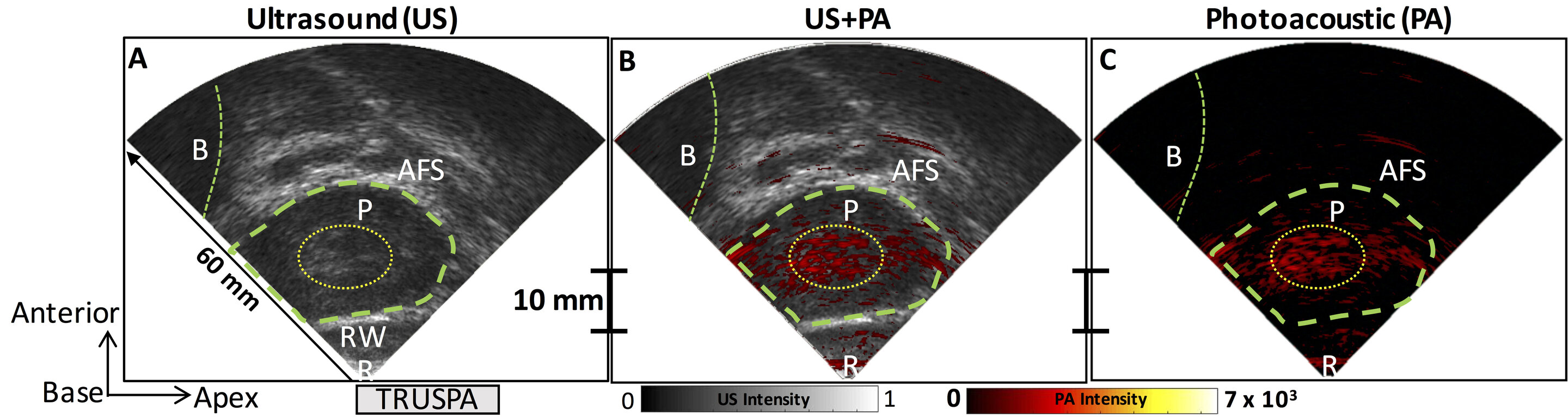 Prostate-imaging camera captures molecular detail to detect cancer - Medical Xpress thumbnail