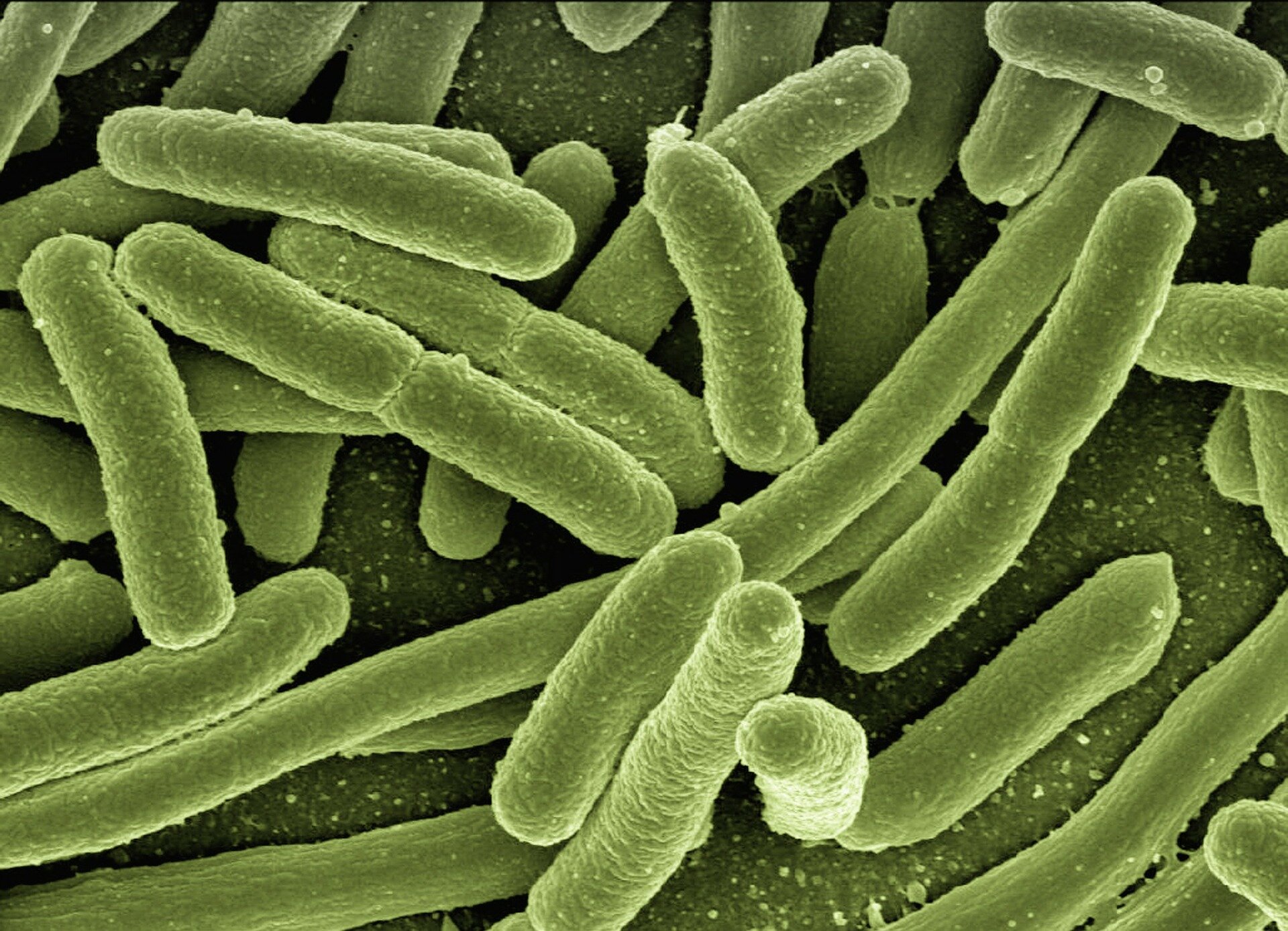 photo of Math reveals how diseases progress and bacteria develop drug resistance image