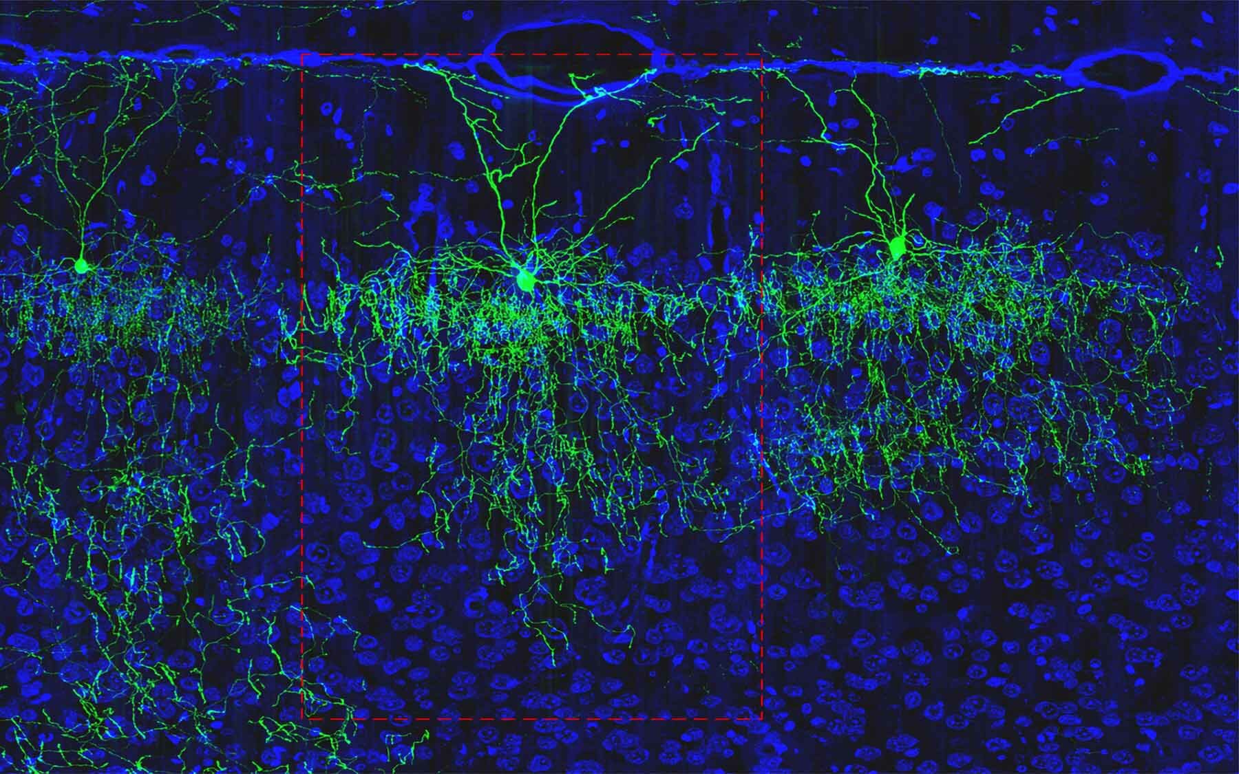 Mice cells. Нейронные сети коры головного мозга. Нейросеть коры головного мозга. Нейронные микросети. Флуоресцентная микроскопия Нейроны.