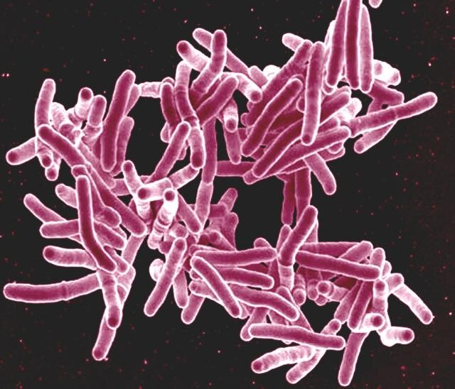 photo of New enzymatic cocktail can kill tuberculosis-causing mycobacteria image